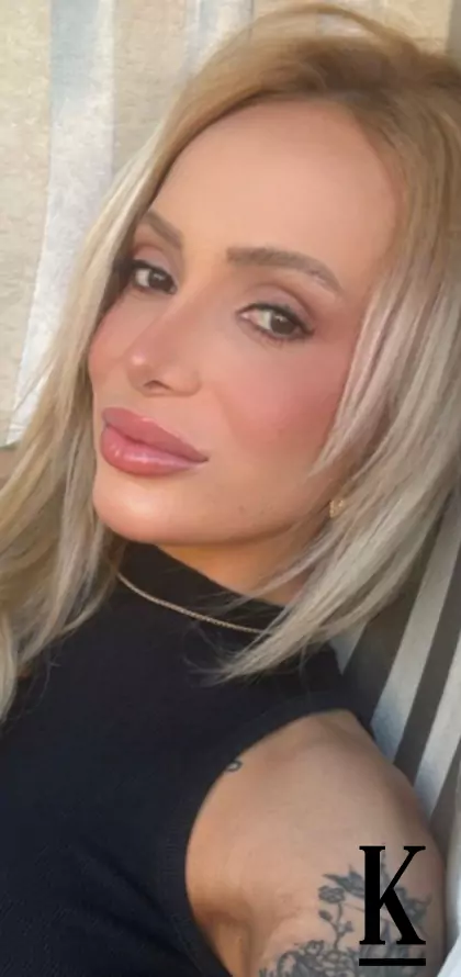 stories-slider-content