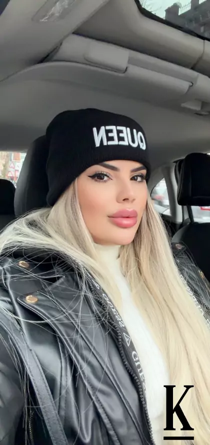 stories-slider-content