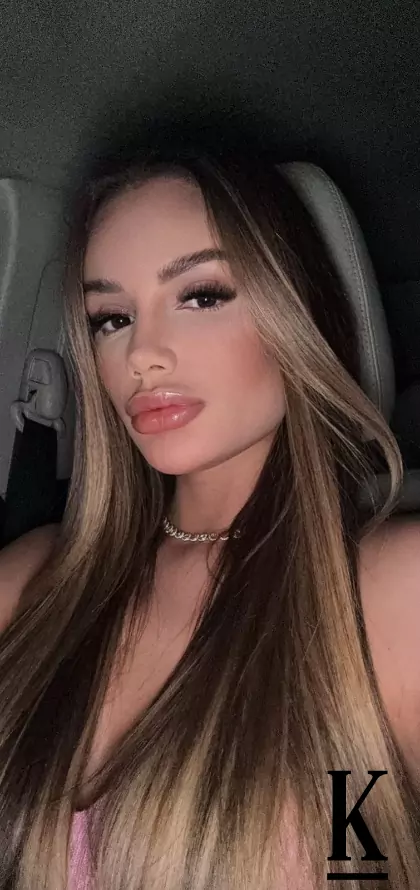 stories-slider-content