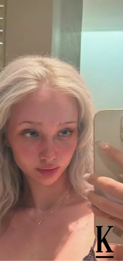 stories-slider-content