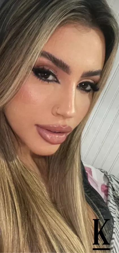 stories-slider-content