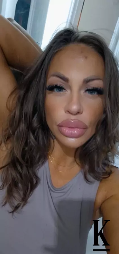 stories-slider-content