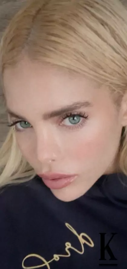 stories-slider-content