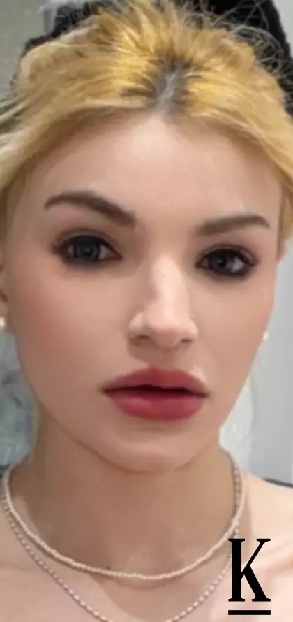 stories-slider-content