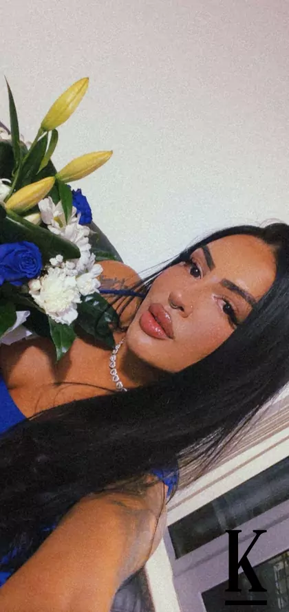 stories-slider-content